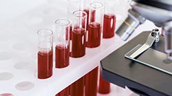 Coronavirus et les assurances 