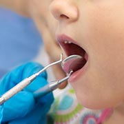 Nantes mutuelle dentaire